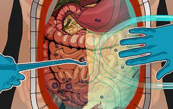 Consult with the number one cancer specialist doctor in Delhi: June 2022