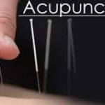 Acupuncture For Low Back Pain Profile Picture