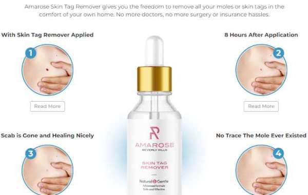 Here Is What You Should Do For Your AMAROSE SKIN TAG REMOVER!