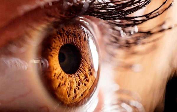 VisiSharp Reviews 2022 And How to Use It