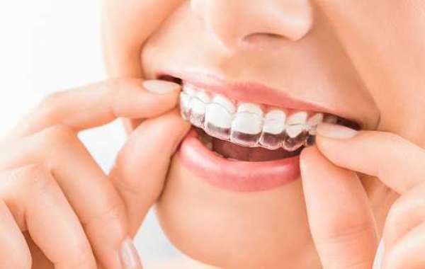 Dental Implants Near Me - Valley Creek Dental Care