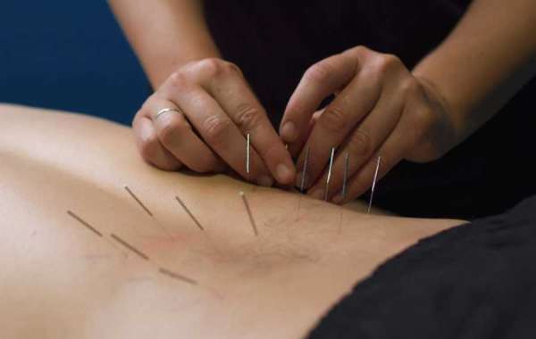 How Dry Needling Can For Good Pain Relief From Chronic Conditions