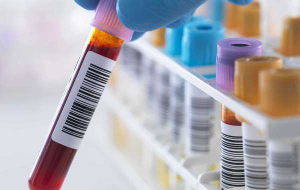 Blood Testing Market Growth Rate, Outlook Analysis to 2022-2031