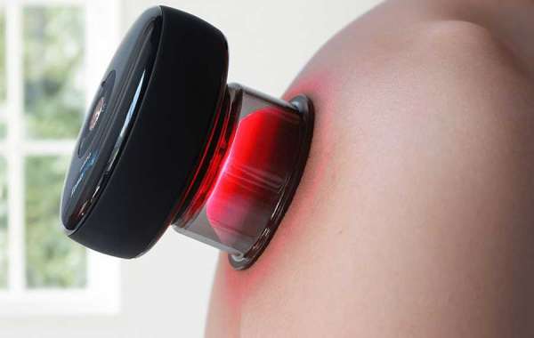 What are the Applications Of Cupping Therapy?