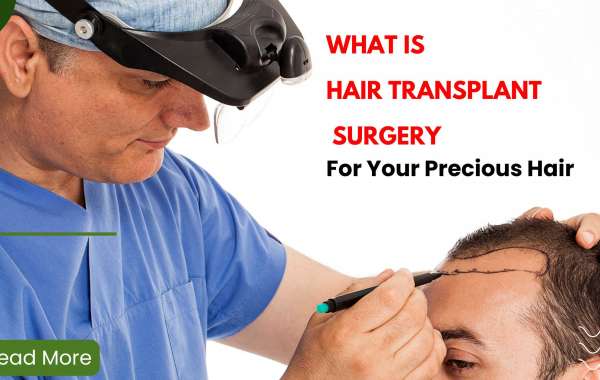 Treatments and Procedures: Hair Transplant