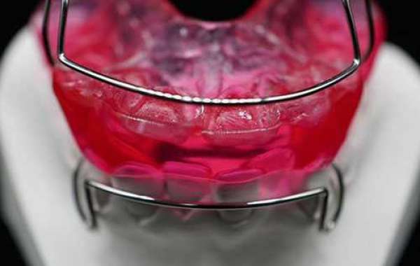 Will dental implants be as durable as real teeth?