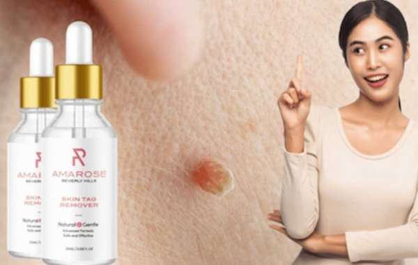 {Be #1 Scam}  Amarose Skin Tag Remover (2023) Don't Buy Before Read Real Price on Website!