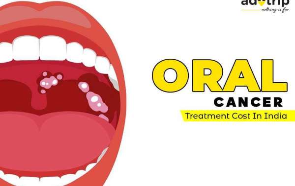 Tips for Reducing Oral Cancer Treatment Costs in India