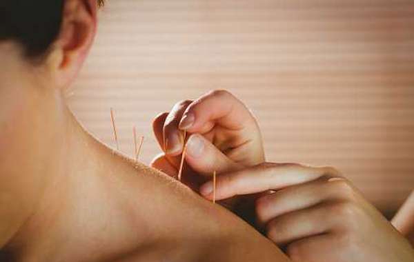 Acupuncture for Neck Pain in Morristown