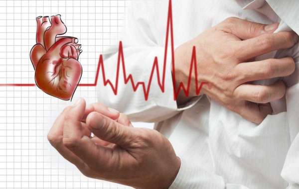 All that You Want to Be Aware of Best Angioplasty in Lahore