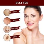 Remedy Skin Tag Remover Profile Picture