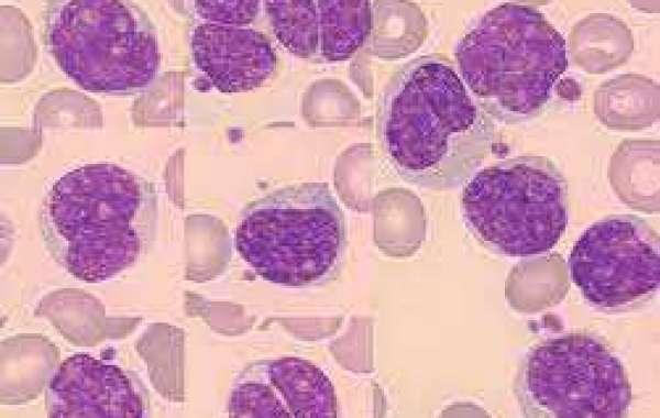 Mantle Cell Lymphoma Market 2023: Epidemiology, Industry Trends, Opportunity And Forecast By 2033