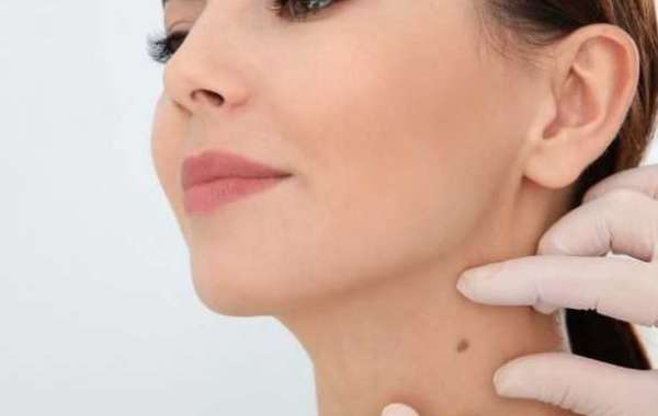 Amarose Skin Tag Remover Scam or Legit: Is It Complete Skin Solution? Before Buying it, Interpret This Impartial View!