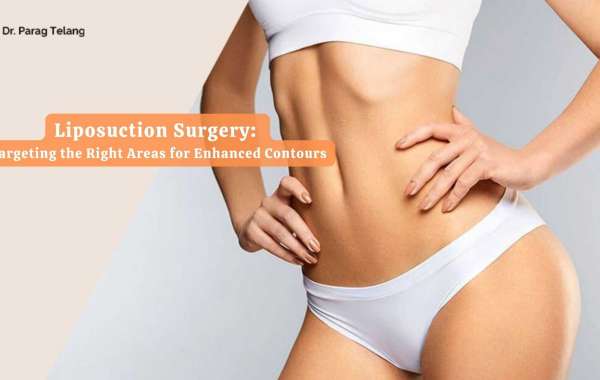 Liposuction Surgery: Targeting the Right Areas for Enhanced Contours