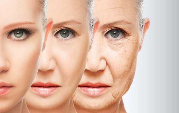 Can a Facelift Eliminate Wrinkles?