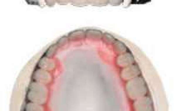 Immediate Dentures: The Revolutionary Solution for Your Oral Health