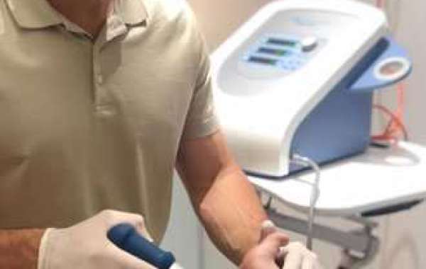 How Much Does a Session of Shockwave Therapy Cost?