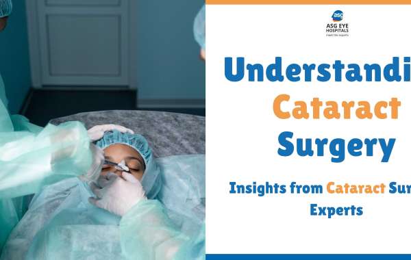 Understanding Cataract Surgery: Insights from Cataract Surgery Experts