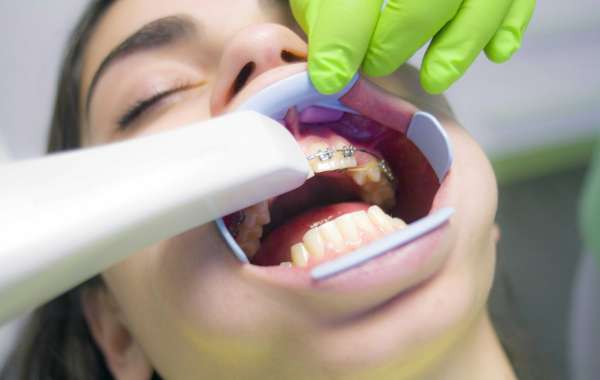 Top 10 Tips for Maintaining Oral Hygiene with Braces