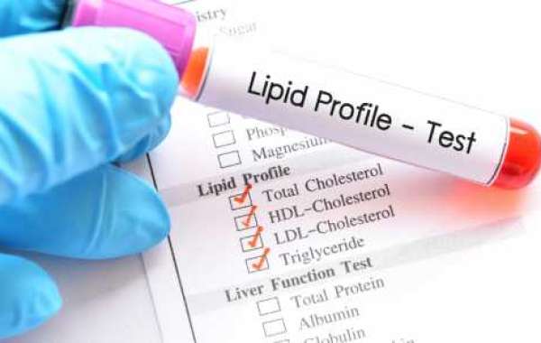 Chughtai Lab's Role in Comprehensive Cholesterol and Lipid Profile Testing