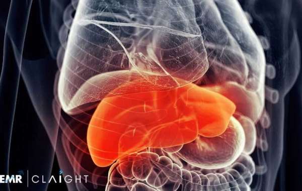 Liver Cancer Screening Market Size, Share & Growth | 2034