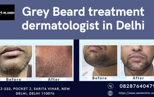 Grey Beard Treatment Dermatologist in Delhi Restoring Your Natural Color